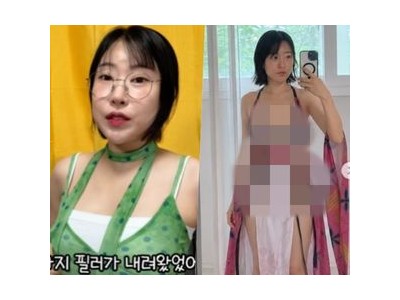 이세영 수술 이유 공개에 온라인 떠들썩